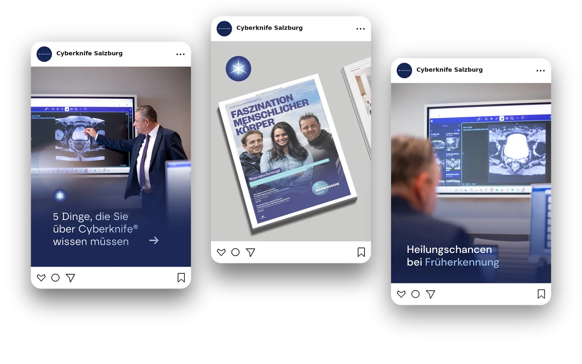 Drei Social-Media-Beiträge von Cyberknife Salzburg: Erklärpost, Magazinbeitrag und Früherkennung